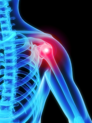 Shoulder pain or shoulder injuries